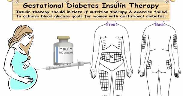 healthyojas's tweet photo. Gestational Diabetes Insulin https://t.co/zRQpPUreUk https://t.co/naTQJQsxnL