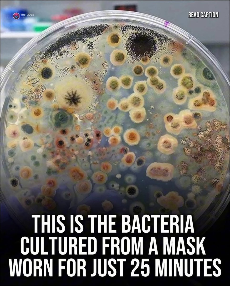 Michael951413's tweet photo. A petri dish swabbed from a mask after less than half an hour reveals a dense colony of multiplying bacteria.

Trapped moisture, restricted airflow, and prolonged wear creates the perfect incubator against your face. 

Masks were mandated as a public health measure in spite of the fact that, as stated by the manufacturers, they don't provide virus protection.

Constant facial covering posed its own risks, such as reduced oxygen intake, discomfort, and bacterial buildup.  This was especially the case for vulnerable groups like children and the elderly.

What if, instead of protecting ourselves, we were just breeding something else entirely? 

https://t.co/H81EMkn7Fh