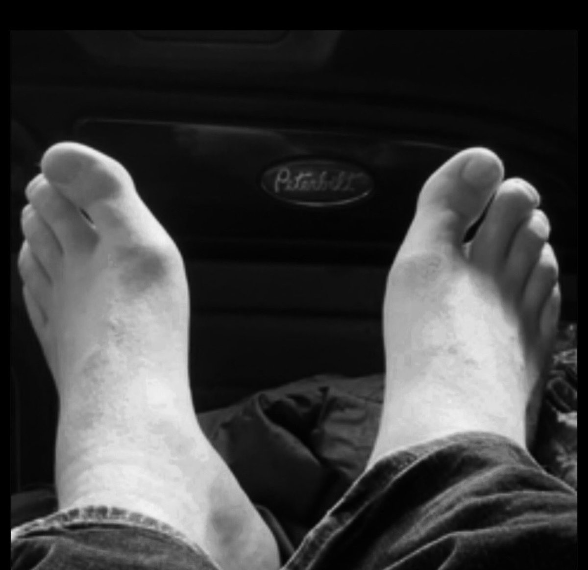 kryptiqsoles's tweet photo. #feet #toes https://t.co/0S0lNc5aWF