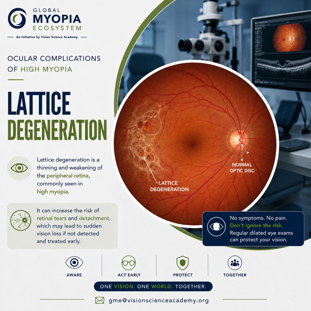 gme_vsa's tweet photo. ⚠️ Lattice degeneration often develops silently - but it can have serious consequences.

Lattice degeneration is a thinning of the peripheral retina that is more common in people with high myopia. 

📩 gme@visionscienceacademy.org

#GlobalMyopiaEcosystem #HighMyopia #Lattice https://t.co/Ywz9n4ewZb