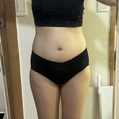 ReadyPs21885's tweet photo. 腹部抽脂＋臀部／骨盆脂肪移植8個月
腰臀線條已自然穩定，
不是刻意的誇張曲線，而是像瘦下來後身材比例變好了。現在穿貼身衣或Leggings，輪廓也更柔順。

#抽脂 #隆乳 #韓國整形 #韓國隆乳 #抽脂隆乳 #醫美分享 #韓國醫美 #隆乳恢復期 #韓國整形外科 #韓國READY抽脂 #韓國READY整形醫院 https://t.co/p63zVVttcP