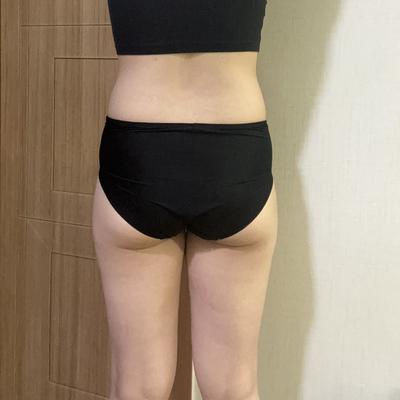 ReadyPs21885's tweet photo. 腹部抽脂＋臀部／骨盆脂肪移植8個月
腰臀線條已自然穩定，
不是刻意的誇張曲線，而是像瘦下來後身材比例變好了。現在穿貼身衣或Leggings，輪廓也更柔順。

#抽脂 #隆乳 #韓國整形 #韓國隆乳 #抽脂隆乳 #醫美分享 #韓國醫美 #隆乳恢復期 #韓國整形外科 #韓國READY抽脂 #韓國READY整形醫院 https://t.co/p63zVVttcP