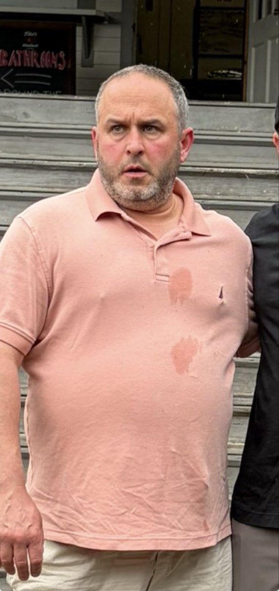 B0nerJamZ2004's tweet photo. @Kaneisable1981 @Menners__ The face of a homeless drunk doxxer https://t.co/R7fDeE3YRL