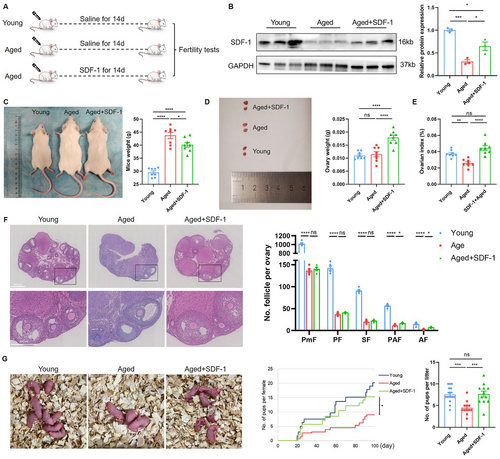 TimePieChina's tweet photo. A previously underexplored role for SDF-1 in alleviating age-related oocyte decline, potentially through autophagy-enhanced stress granule scavenging:
#Reproductive #Aging
https://t.co/Geg5jouHNJ https://t.co/dHOqINdQ2K