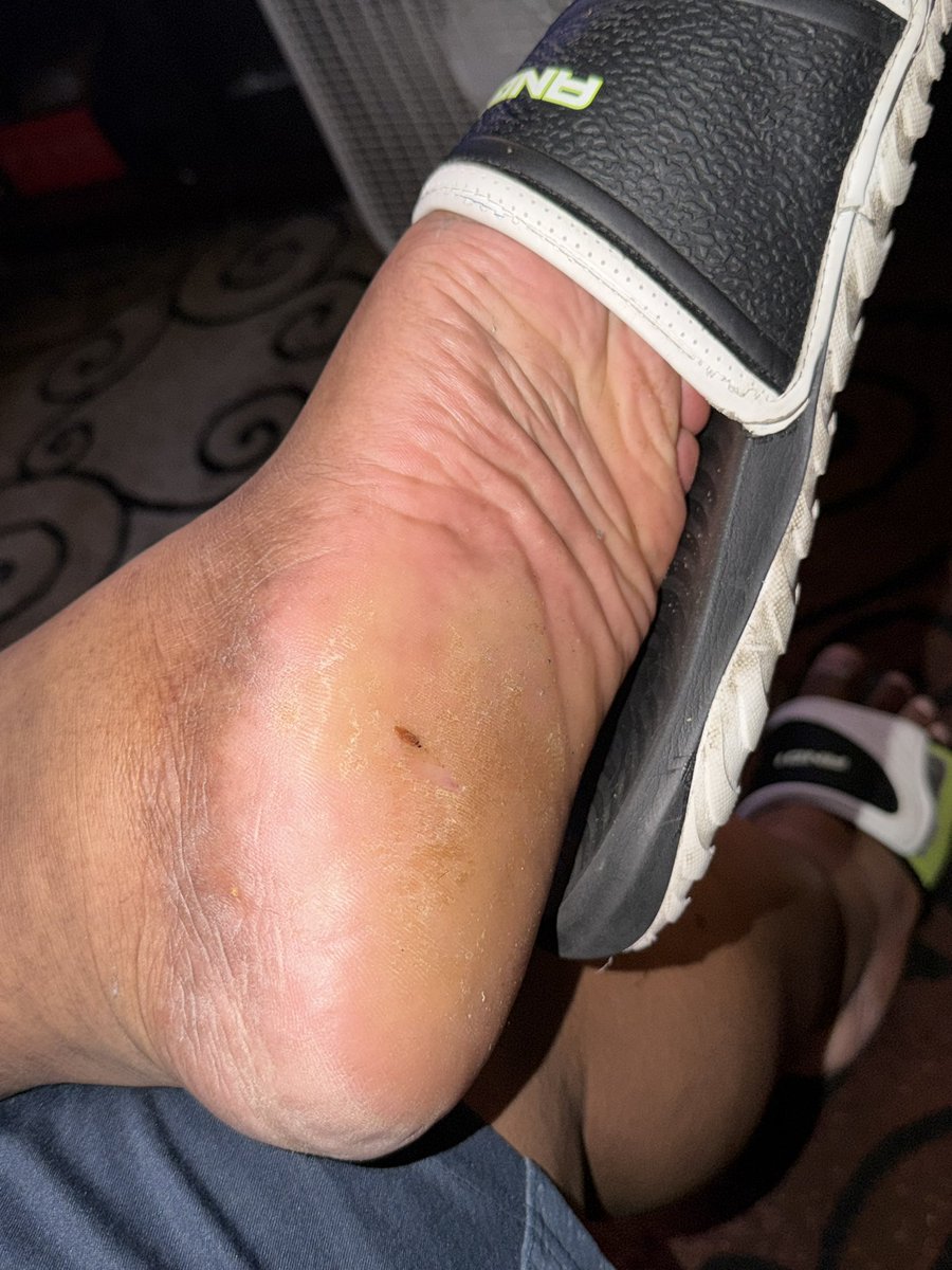 BigBoyFeet97's tweet photo. I need a good boy to give me a foot massage https://t.co/bHjOaKanMl