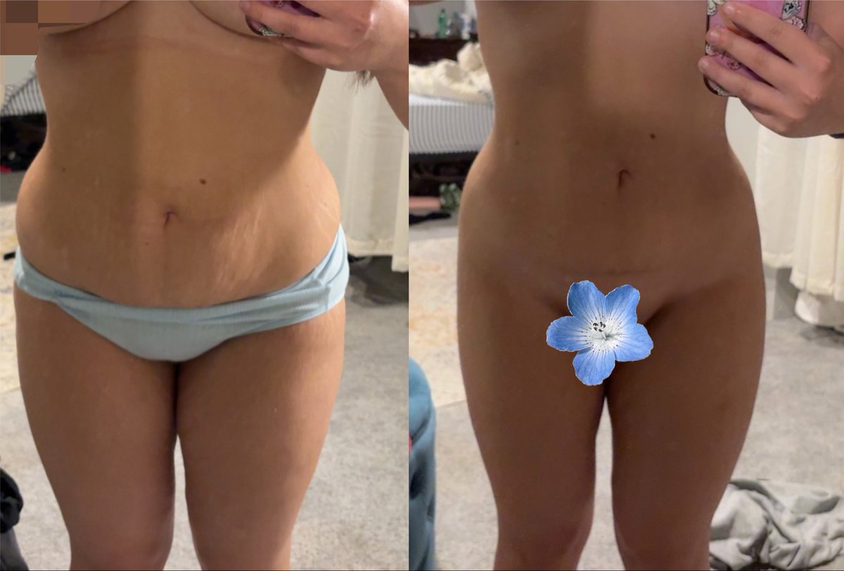 m4rex1a's tweet photo. left is july 3rd &amp; right is aug 3rd

bye love handles https://t.co/g6r8oyVOHY