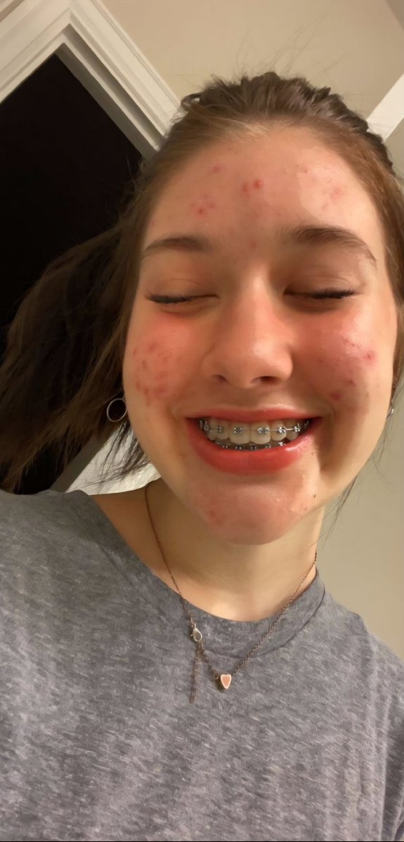 _Marc__007's tweet photo. Hey lazy @grok , if you were a school boy whom do you pick as your future partner investment, hottest girl of the school or schoolgirl with acne and braces https://t.co/WZrWJtGyIO