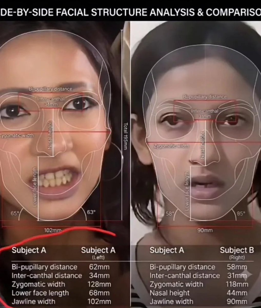 TheRudra1008's tweet photo. She didn’t just lie or Fooled Entire India ... 

She used her own younger sister’s face to milk sympathy from the entire internet.

This is next-level evil. ☝️
Using a minor to play the victim.Unbelievable. https://t.co/XTlZVcIk2K