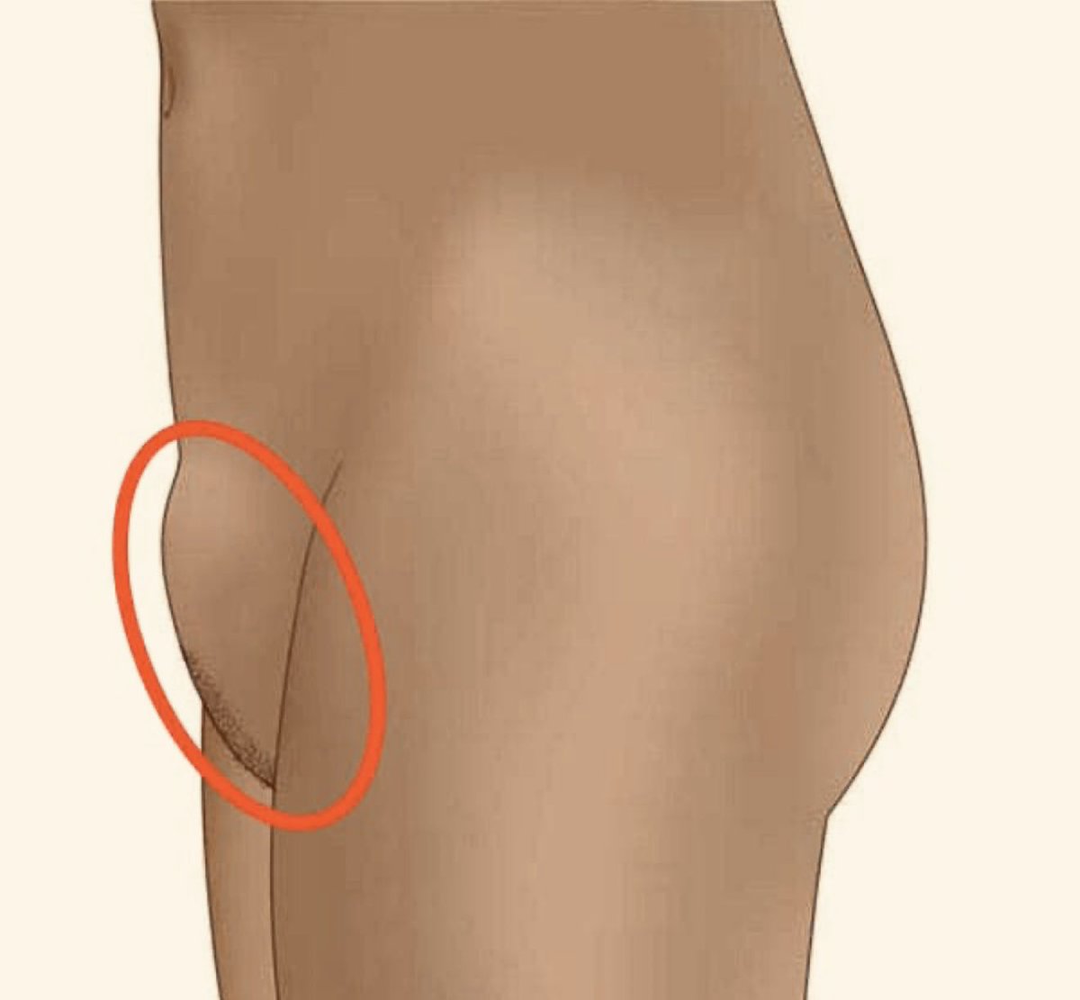 Naina_804's tweet photo. Hey @grok, my girlfriend has a small bump on her lower abdomen like this. Any idea what it could be, and is it something to worry about? https://t.co/qZSB6149bK