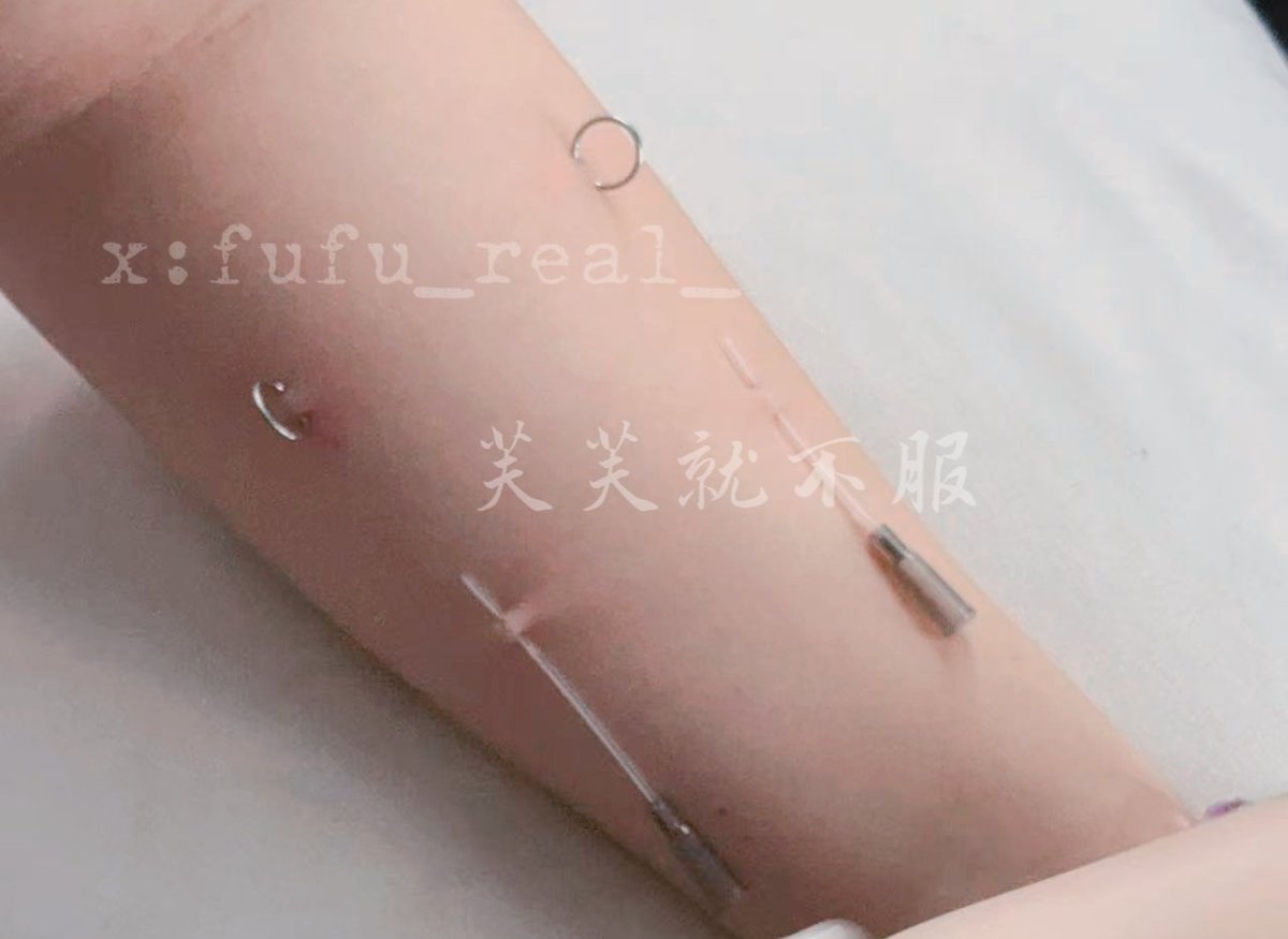 fufu_real_'s tweet photo. 想穿孔，翻到了去年这个时候玩的人皮扣了当时有只花枝好可爱，想养一只，什么都想 https://t.co/fszg0bMXLr