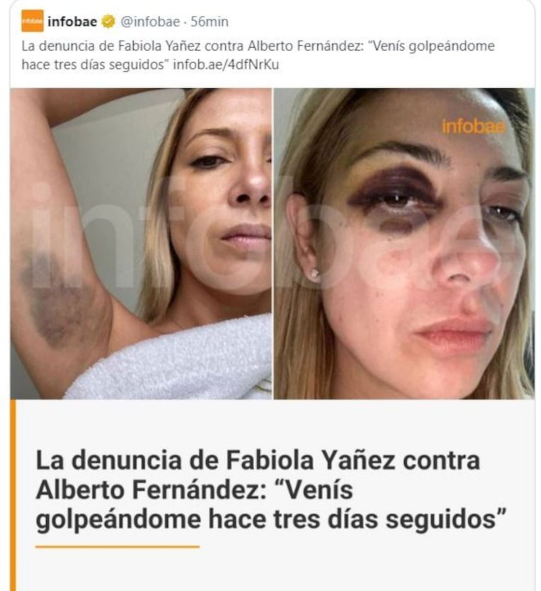Karblack111's tweet photo. Robertito, te encanta rodearte de pegalones. https://t.co/0cldcQA1va