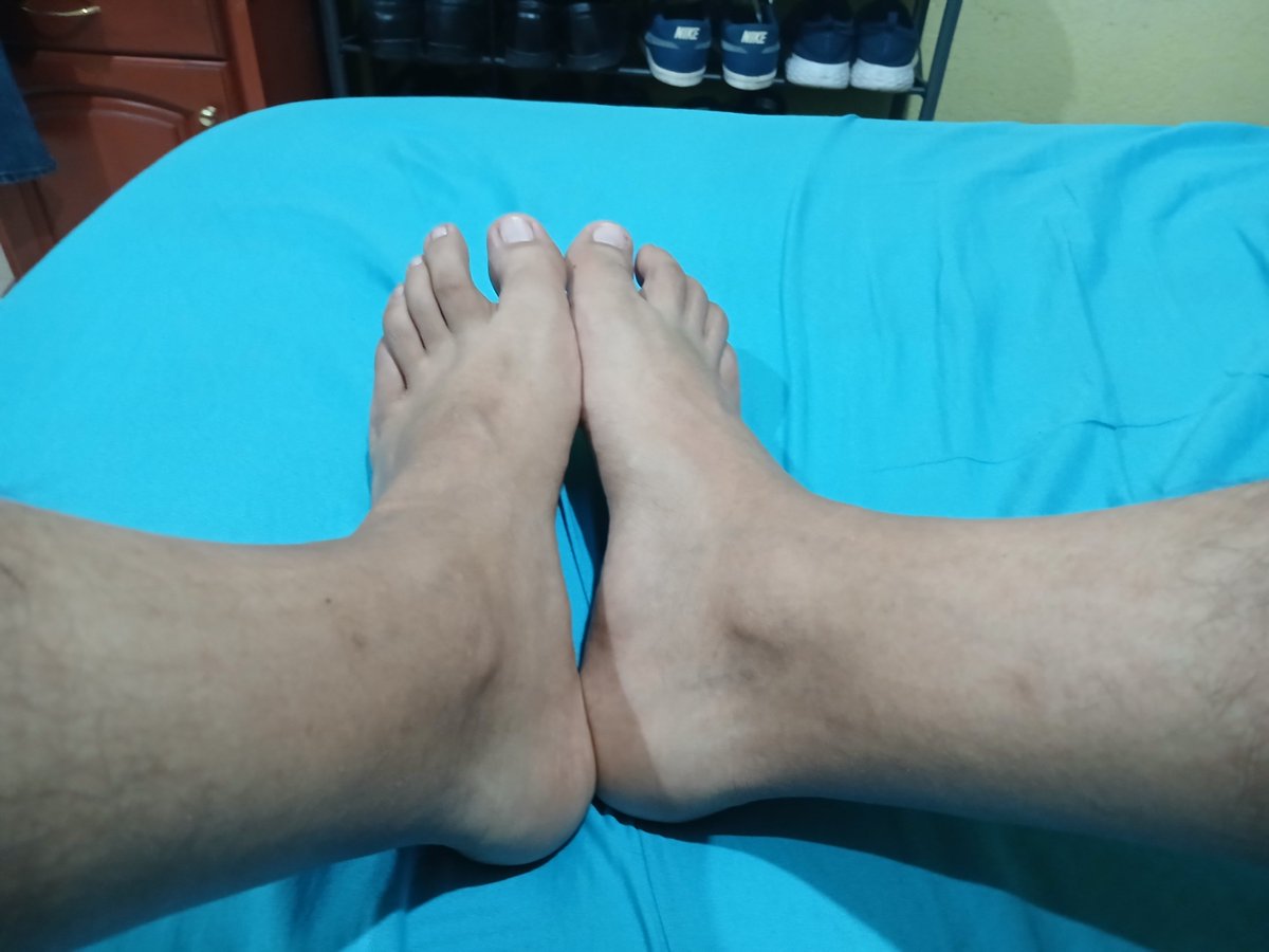 Cessart27's tweet photo. Tengo pies medio feos. A ver los tuyos... https://t.co/cF7vYPaBN3