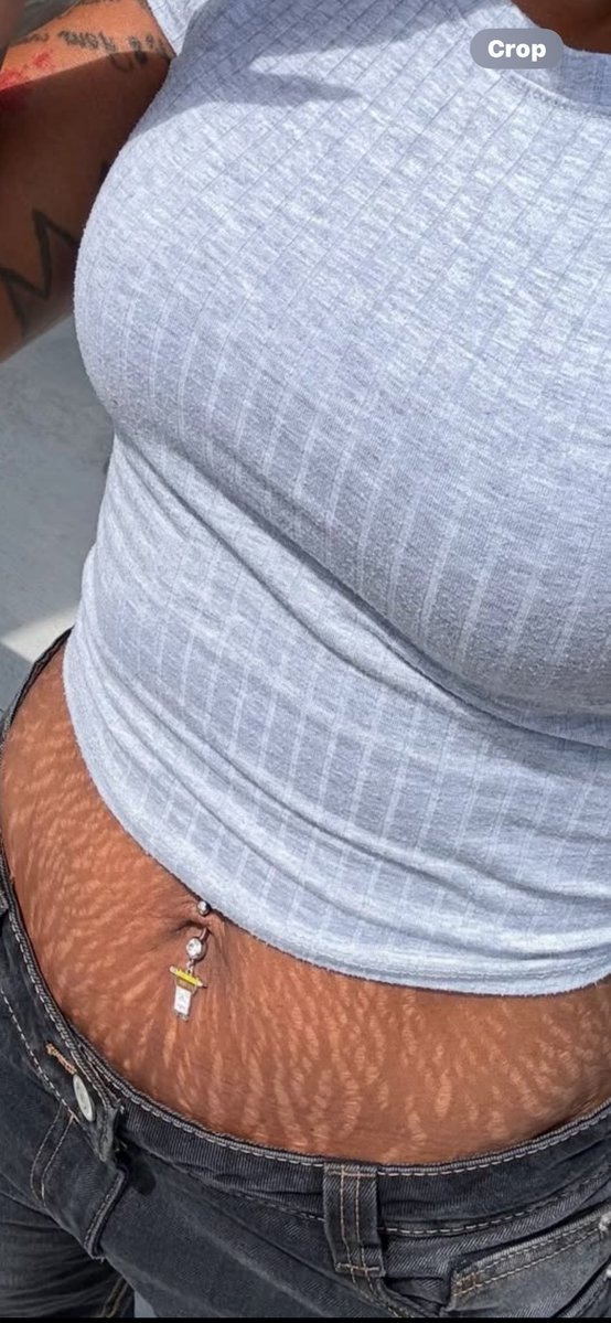 RjNkD10's tweet photo. A good afternoon starts with a sight on sexy stretch marks😜 https://t.co/8DPoT7qU0U