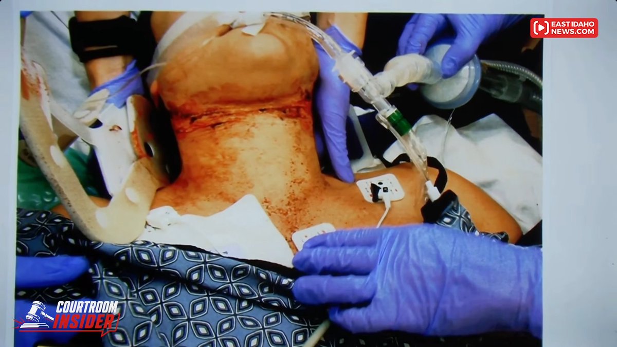 iCkEdMeL's tweet photo. ⚠️ Graphic injury photos – sensitive content, discretion advised.

This Lindsay Clancy trial would've been crazy to cover.

I'm intrigued by the story, all the medications, and the divide in this story.

And Dr. Kelly Mcdonough described these injuries as superficial; Do you think they are? And is she implying when Lindsay did this, she really wasn't trying to off herself? even though she jumped from the window?

I'm still watching the prosecution, but I saw a snippet of the defense, I like the defense lawyer, firecracker.

But this Doctor seems to have recalled everything during prosecution but nothing during defense?