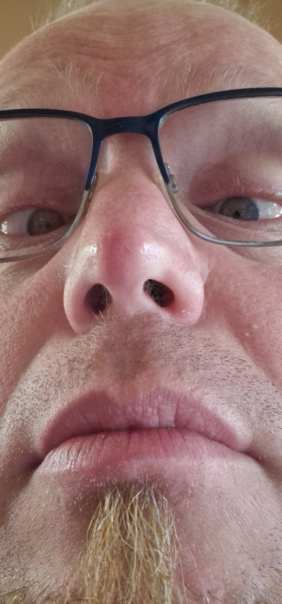 bertjebe's tweet photo. Er groeit een pukkel op t uiterste puntje van m'n neus...
Hoe oud ben ik? Twaalf?
#GaWeg #DoetZeer https://t.co/wmHdKYrheT