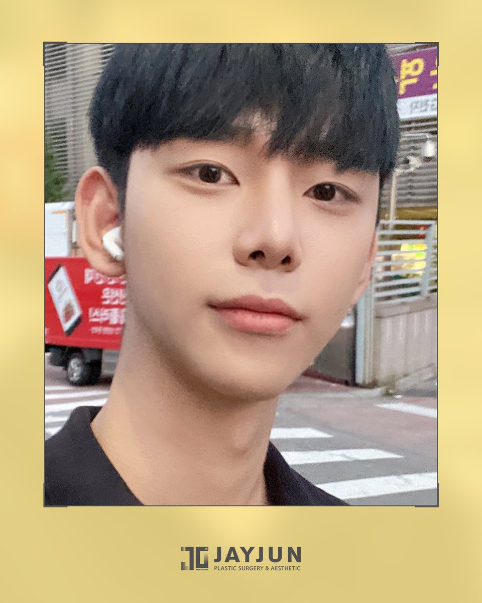 jayjun_jpn's tweet photo. 男性美容医療で見るべきなのは、
価格や変化量だけではありません。

誰が診断し、
誰が執刀し、
麻酔・術後管理までどう設計されているか❕

JAYJUNでは、
形成外科専門医による1:1診療、
麻酔科専門医常駐、
代理手術ゼロ、
手術室CCTV設置の体制で診療を行っています。

派手に変えるのではなく、
自然に印象を整えるための医療です。

━━━━━━━━━━━━━━━━
🏥 JAYJUN美容外科｜ソウル江南
🇯🇵 日本語通訳常駐
📩 LINE：https://t.co/5uZjGbm2xi
━━━━━━━━━━━━━━━━

※腫れ・仕上がり・ダウンタイムには個人差があります。

#クリニック選び #メンズ整形 #男性美容医療 #韓国整形 #江南美容外科 #代理手術ゼロ #形成外科専門医  #日本語対応