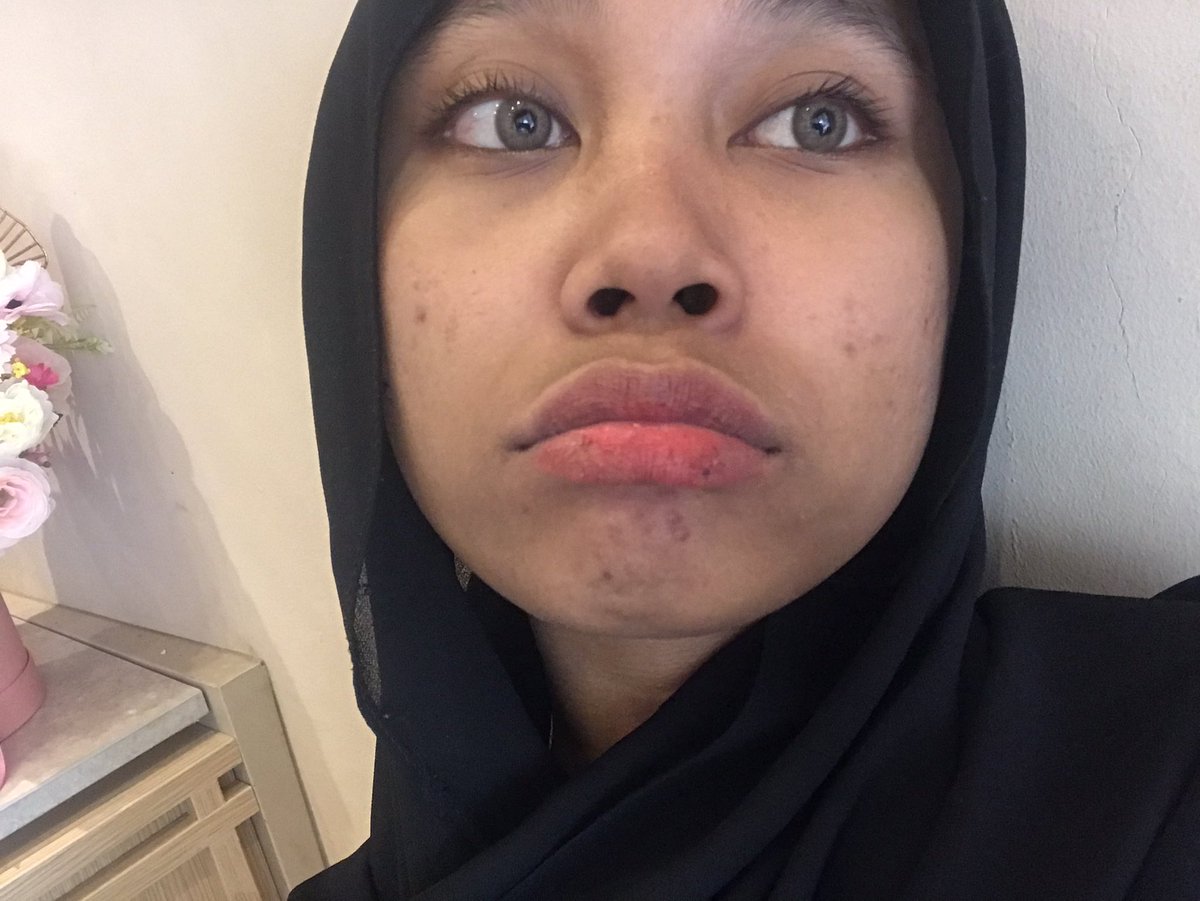 dieyforu's tweet photo. barefaceeed kindaday :)))$ https://t.co/v5ayhfgoYp