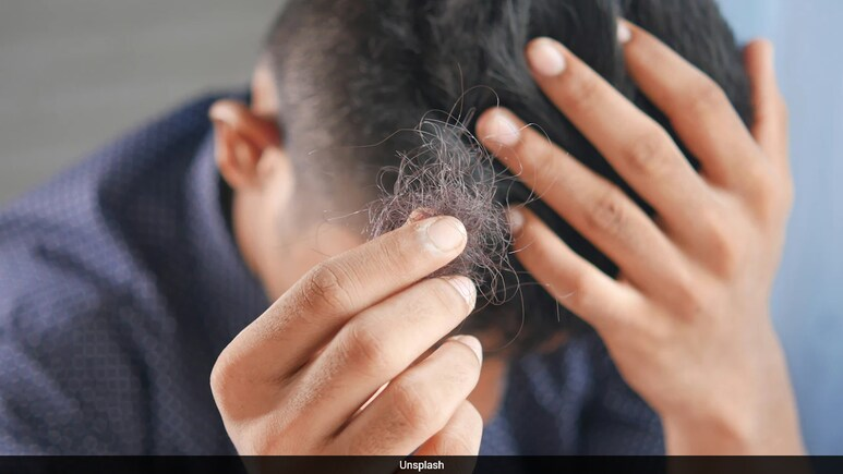 ndtv's tweet photo. Ozempic Users Warned Over Hair Loss Linked to Weight Loss Jabs
https://t.co/lDLkXdXbYV https://t.co/NofA2BLXpm