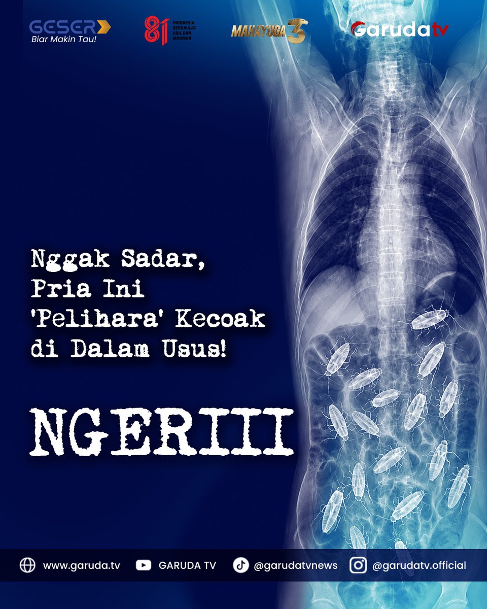 garudatvnews's tweet photo. Tapi dalam kasus ini, jalur masuknya tetap menjadi misteri.
Kasus ini dilaporkan dalam Mexican Journal of Gastroenterology pada Desember 2025.
Naskah | Admin: SF
Grafis: UP
#geser #kecoak #usus #ngeri #viral https://t.co/LaK87fdmSt
