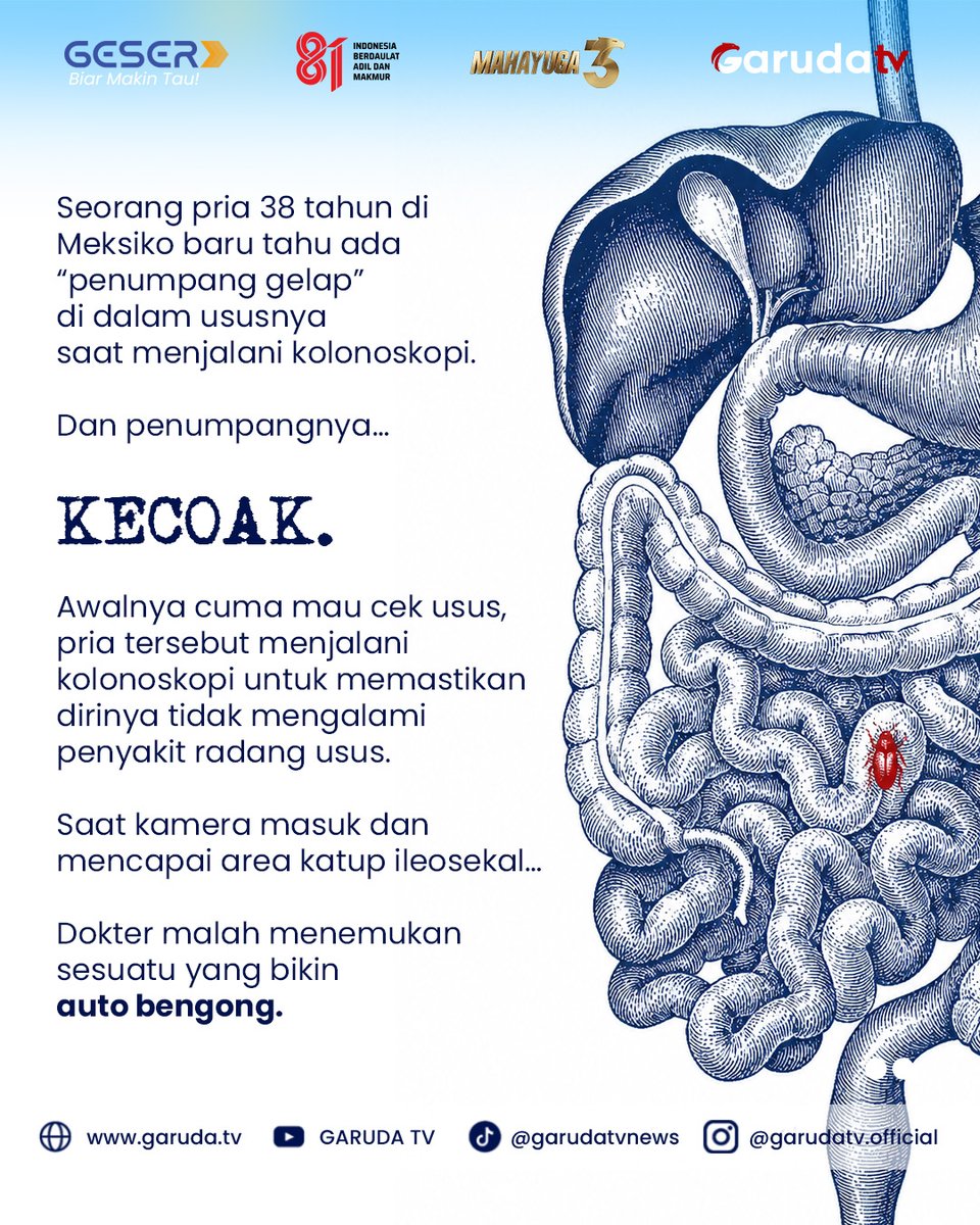 garudatvnews's tweet photo. Tapi dalam kasus ini, jalur masuknya tetap menjadi misteri.
Kasus ini dilaporkan dalam Mexican Journal of Gastroenterology pada Desember 2025.
Naskah | Admin: SF
Grafis: UP
#geser #kecoak #usus #ngeri #viral https://t.co/LaK87fdmSt