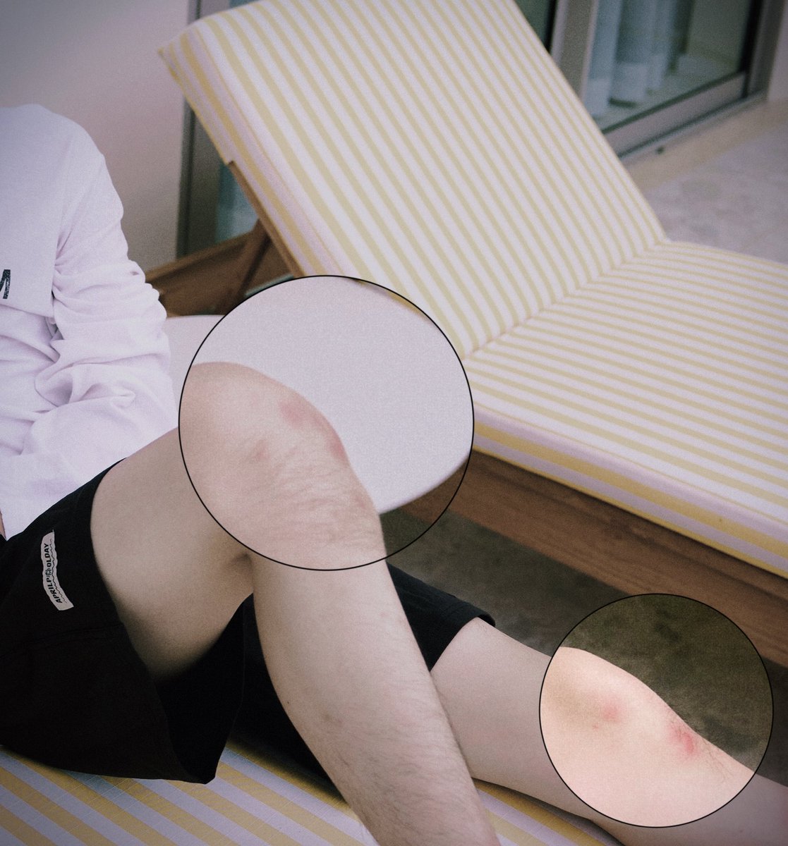 lululu_66666's tweet photo. Poor baby🤏🏻
so many bruises on your knees. 
Are these the inevitable hardships a mermaid must go through to become human?@ppoohkt 

#ppoohkt  #PooHHooPers https://t.co/HDCxF0TsYA