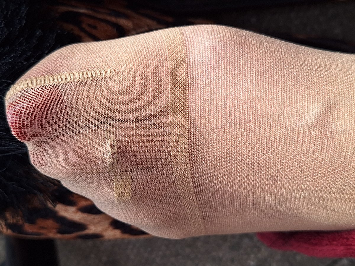 nylonteazer tweet picture