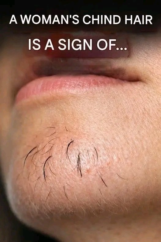 emediong111's tweet photo. A woman’s chin hair is a sign of…See more https://t.co/iEekWRYWs9