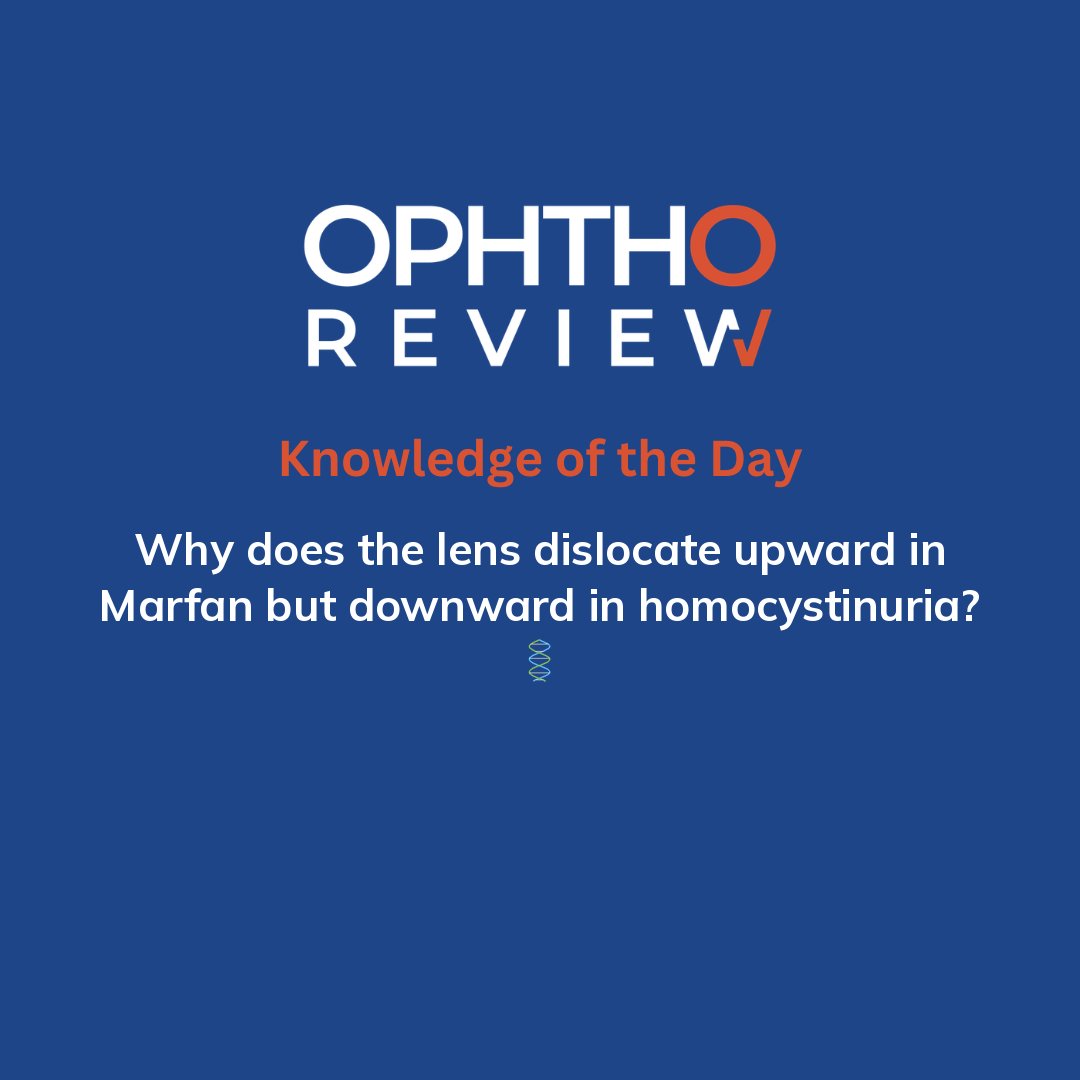 ophthoreview's tweet photo. Marfan syndrome

#ophthoreview #ophthalmology #ophtho #ophthalmologyresidency #ophthalmologist #surgicaleducation #medicaleducation #meded #surgery #medicalstudent #medicine #medicalschool #resident #residency https://t.co/tSmntftDWF