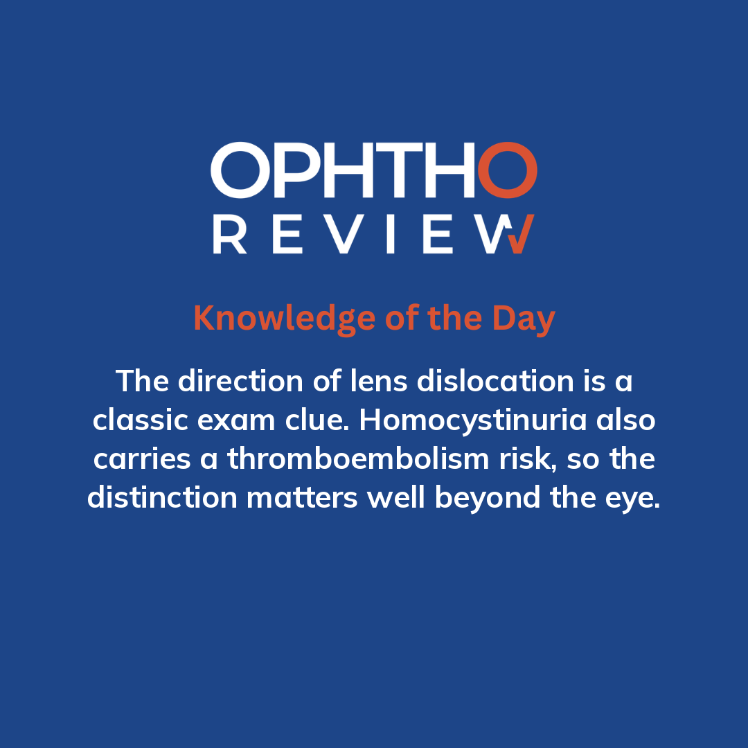 ophthoreview's tweet photo. Marfan syndrome

#ophthoreview #ophthalmology #ophtho #ophthalmologyresidency #ophthalmologist #surgicaleducation #medicaleducation #meded #surgery #medicalstudent #medicine #medicalschool #resident #residency https://t.co/tSmntftDWF