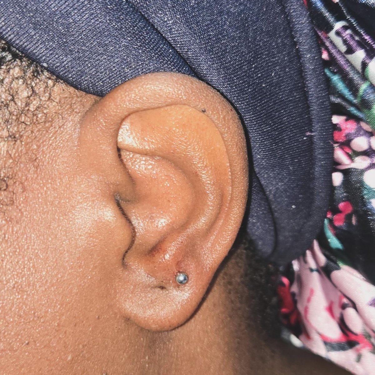 imose_ng's tweet photo. Second lobes https://t.co/3IIIYljuZ2