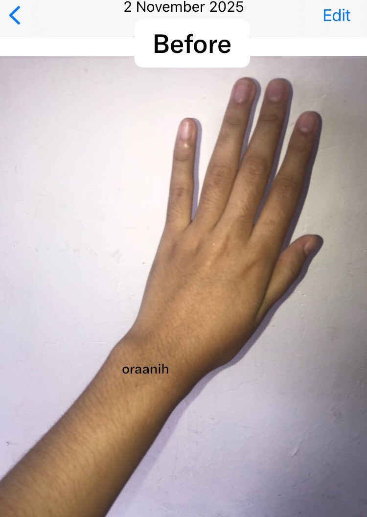 oraanih's tweet photo. Best purchase💫💗
tahun lalu ada kegiatan panas”an di lapangan😣😭 edisi bodycare bagus mencerahkan kulit dan ngilangin bekas luka versi low budget, ingat kuncinya konsisten☺️👍🏻
thread~ https://t.co/uLg6gwQ6HJ