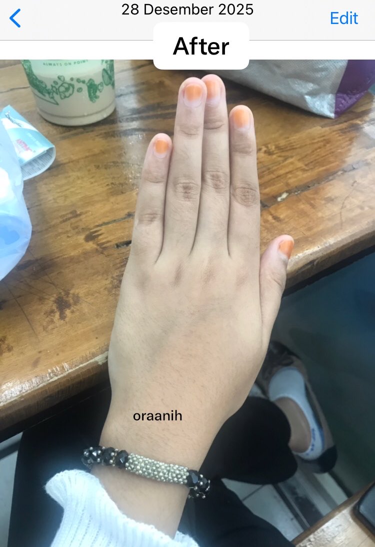 oraanih's tweet photo. Best purchase💫💗
tahun lalu ada kegiatan panas”an di lapangan😣😭 edisi bodycare bagus mencerahkan kulit dan ngilangin bekas luka versi low budget, ingat kuncinya konsisten☺️👍🏻
thread~ https://t.co/uLg6gwQ6HJ