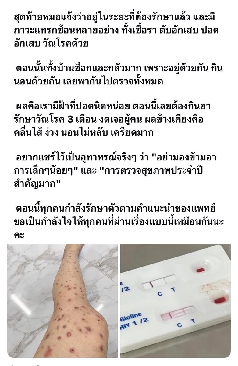 volleyppk's tweet photo. ไถ่ฟีดไปอ่านเจอโพสต์นี้มา คือช็อกมากก
นี่สินะ ที่เขาถึงบอกว่ารู้หน้าไม่รู้ใจจริงๆ
ขนาดเราไม่ได้เอาตัวเองไปอยู่ในกิจกรรมที่มีกลุ่มเสี่ยง แต่ก็ใช่ว่าจะไม่เจอ
ช่วงนี้ได้ข่าว HIV ระบาดมากในหลายพื้นที่
อยากให้ทุกคนดูแลตัวเองกันด้วยนะครับ
ที่สำคัญการตรวจสุขภาพประจำปีสำคัญมากๆ เพราะเราไม่รู้ตัวจริงๆ ว่าแต่ละวันร่างกายไปเจอกับอะไรมาบ้าง