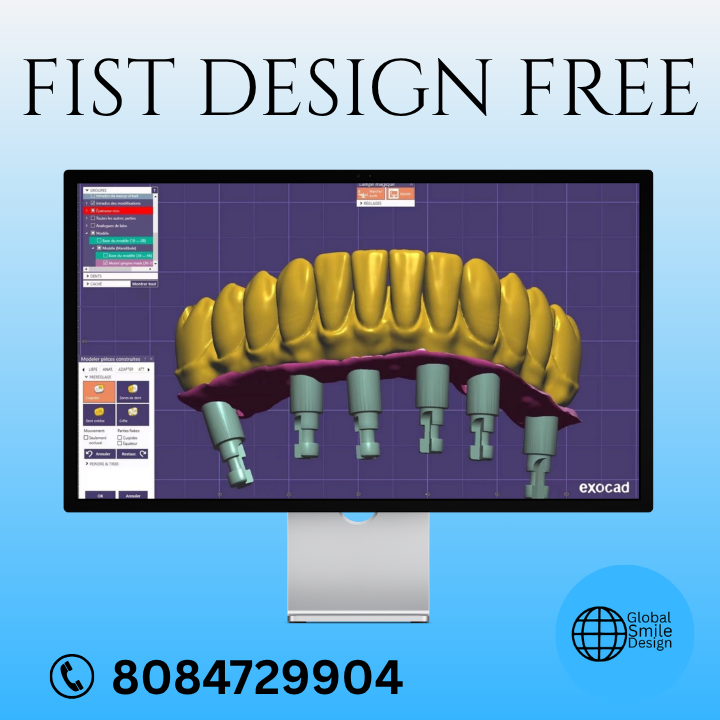 cglobaldesign's tweet photo. FIST DESIGN FREE
Outsource your CAD design to Global Design consultancy
Contact us for a full price list
Please email us at: infoglobalsmiledesign@gmail.com
#DentalCAD #DentalCAM #DentalDesign #zirconiadenrallab
#GlobalDesignConsultancy #GlobalSmileDesign #GlobalDentalLab https://t.co/dY3rnnLJae