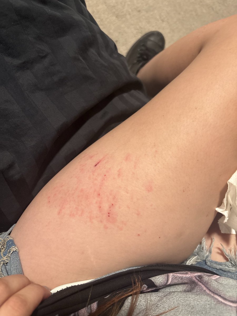 tia__joness's tweet photo. i had such a bad wipe out breaking my nieces fall 😭😭 https://t.co/gHtcXb5r03