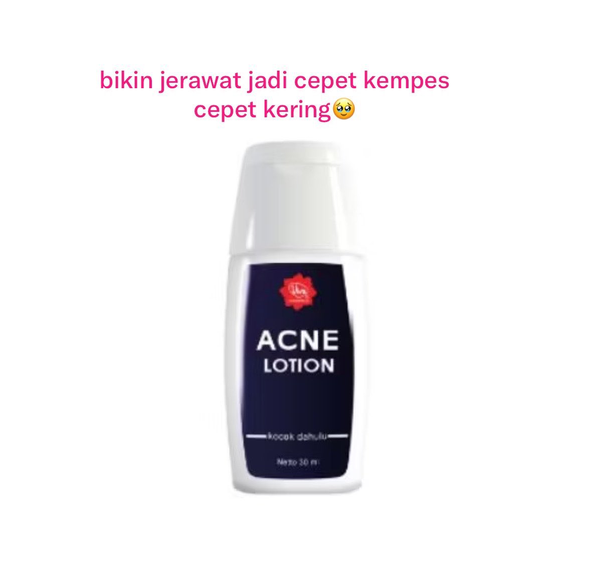 fellwya's tweet photo. nah dua produk ini suhu🔥, definisi kecil kecil cabe rawit, serumnya ga kaleng kaleng, terus Acne lotion, buat yg sering muncul jerawat hormonal wajib punya! https://t.co/m7F3fz2HcJ