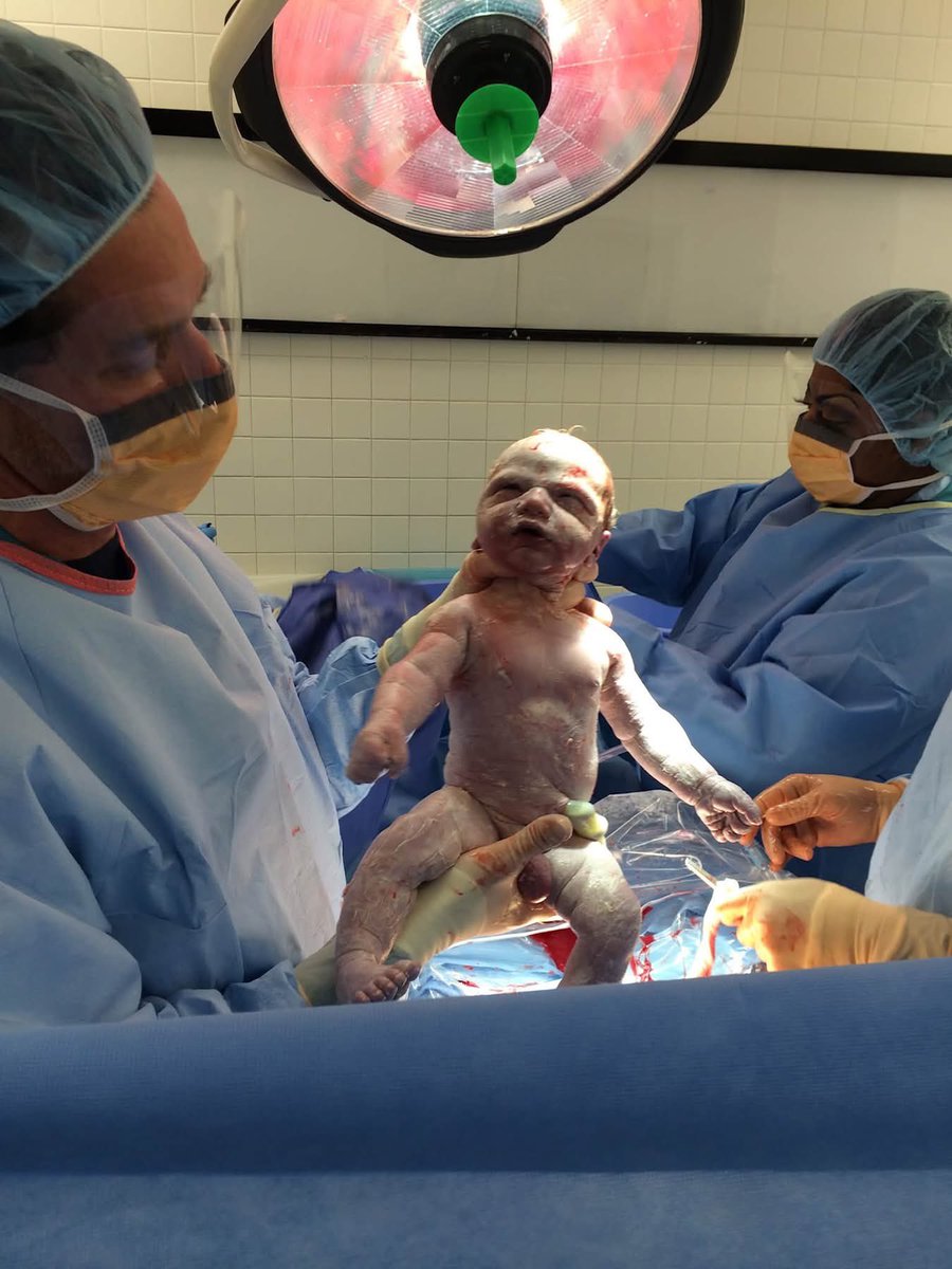 toobaffled's tweet photo. “When I think about the people I personally know who Fauci killed, I think about my OBGYN who delivered both my babies, Dr. Jay Goldberg. 

In 2021 he and I actually had several heart to heart conversations about how I believed he should not be vaccinating any of his patients (esp the pregnant ones) because I believed the Covid vax would increase miscarriages and infertility. He shrugged and chuckled at my statement, but said he’d look at whatever research I’d give him. So I sent him several studies. He told me  he read them and they were interesting, but not credible sources. 

As a doctor of Cedars Sinai Hospital he was mandated to get the vaccine and multiple boosters. Shortly after receiving one of his many boosters he went mountain bike riding and died of a heart attack. He was only 53 years old. And he was is excellent shape. 

While he wasn’t exactly a personal friend, he was a doctor who I confided in for over 20 years. He was a great doctor. Amazing bedside manner. Always funny. Always comforting. Loved his family (he had two teen boys). And just an all around good guy. And he was the first person to hold my babies and bring them into this world safely. But Fauci and his lies killed Dr Goldberg in 2022 and I’ll never forgive or forget that.”

- Shannon Kroner -

https://t.co/ZnGoEGelYE