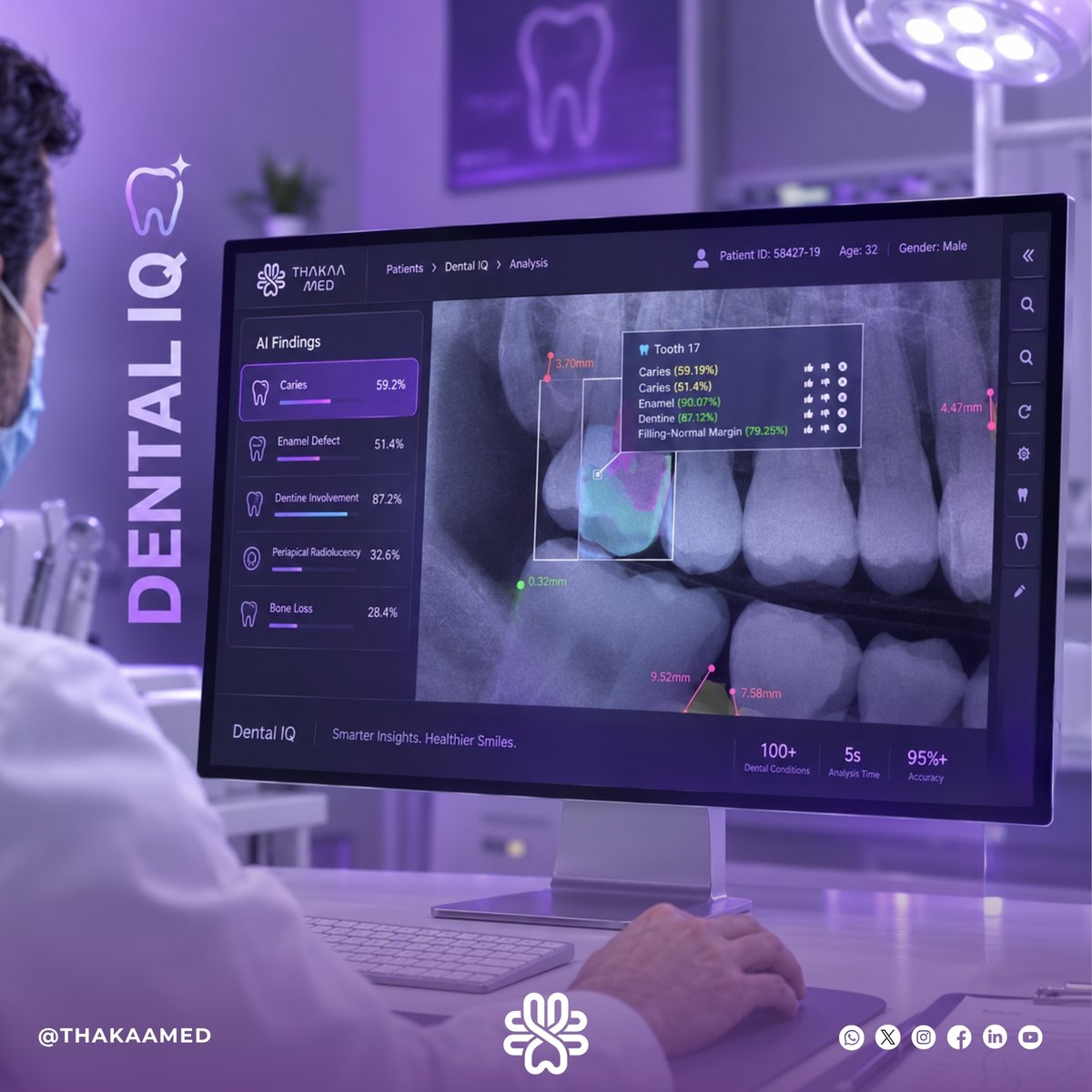 Thakaamed's tweet photo. Most of this tooth's damage was invisible — until the scan.

Measured. Mapped. Flagged. In seconds.

Is the gap in dental diagnosis about technology — or the time we give ourselves to use it?

#DentalAI
#الذكاء_الاصطناعي_الطبي https://t.co/CiM3leZKbP