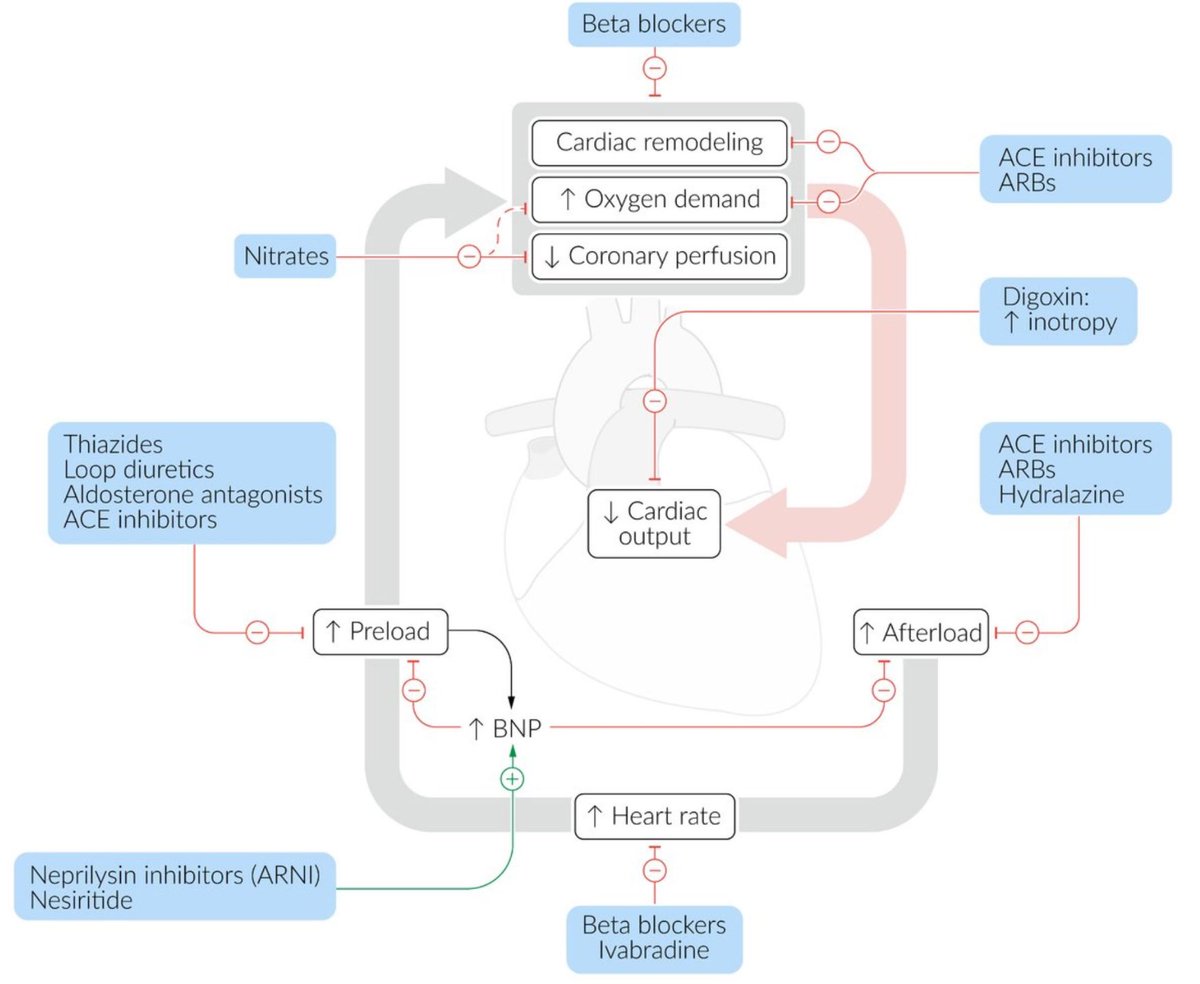 private_relay's tweet photo. pause and absorb cardiology flow chart 
courtesy @ambossmed 
#medtwitter #mbbs https://t.co/re18y2TX8F
