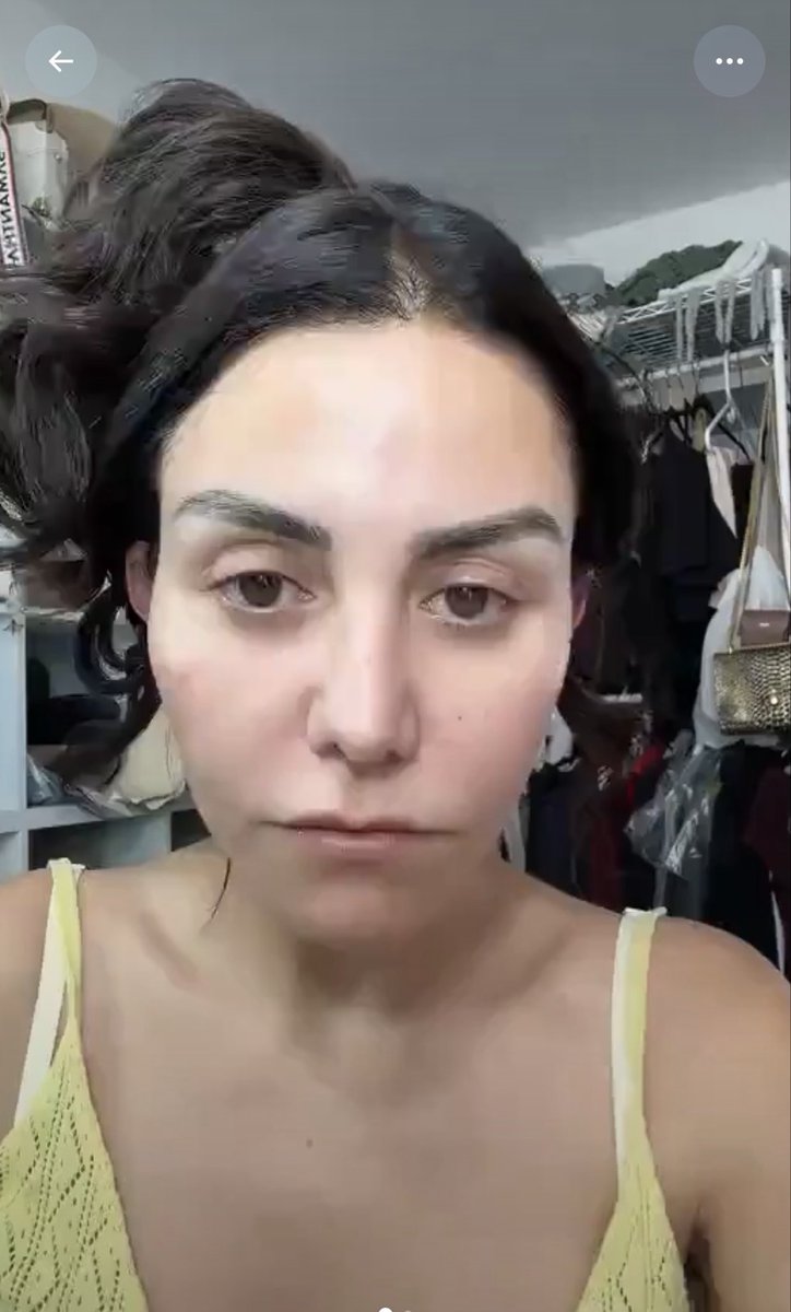 CarlosTorresF_'s tweet photo. Lo lograron, finalmente lo rompieron. Finalmente ganaron. Destrozaron a alguien que siempre estaba feliz, que siempre estaba sonriendo. Alguien que no merecía el odio (guiño, guiño). Alguien que no hacía nada más que insultar a las personas. Alguien que despotricó con todo su corazón.

Adiós @Naysalvatori, nadie te va a extrañar.