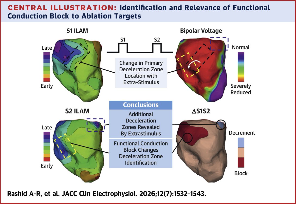 JACCJournals's tweet photo. Extrastimulus affects DZ location and can reveal hidden DZs, while functional conduction block can mask DZs seen on S1 maps. ΔS1S2 maps demonstrate a visual representation of assimilation of the information within S1 and S2 maps. https://t.co/w9USuWXoc6 #JACCCEP https://t.co/zvOiOBFQY7