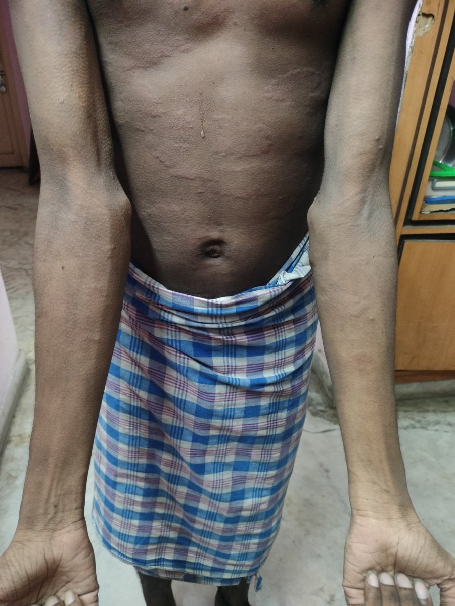 CultReigns's tweet photo. Ma Thammdu Ki ela Body Meda infection Any Doctor in My Tl Please RIT Vasyablity @miryalasrikanth https://t.co/b7W4z8ad9d