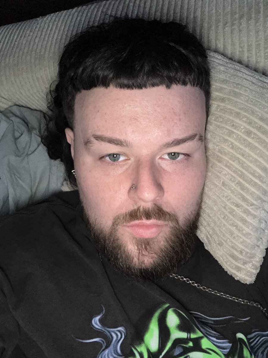 Nigger1015641's tweet photo. @Dingledewdah @Jxxyy This is what joeyy really looks like. Also I wouldnt be talking about usernames if my name was dingle. https://t.co/9e6eWtoX8m