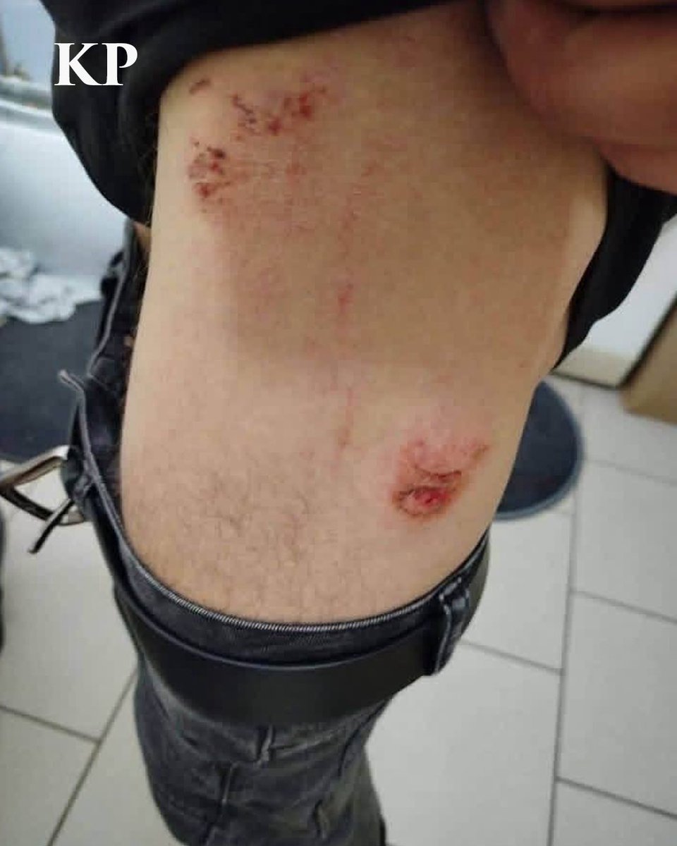 KyivPost's tweet photo. Three Ukrainians were attacked at a hostel in Poland after a man allegedly shouted “go back to Ukraine” over music playing from their car and returned with others.

The victims suffered head injuries. Ukraine’s Consulate says it is in contact with the victims and Polish authorities, while police are investigating the attack.