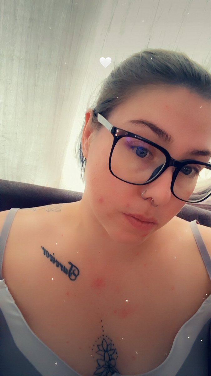 BeautifulTemp26's tweet photo. Skin is breaking out something chronic. 
Which little Winnie is gonna fund a facial for me. 

Findom paypig sub findomme whalesub cashcow https://t.co/WbyHbqEaoQ