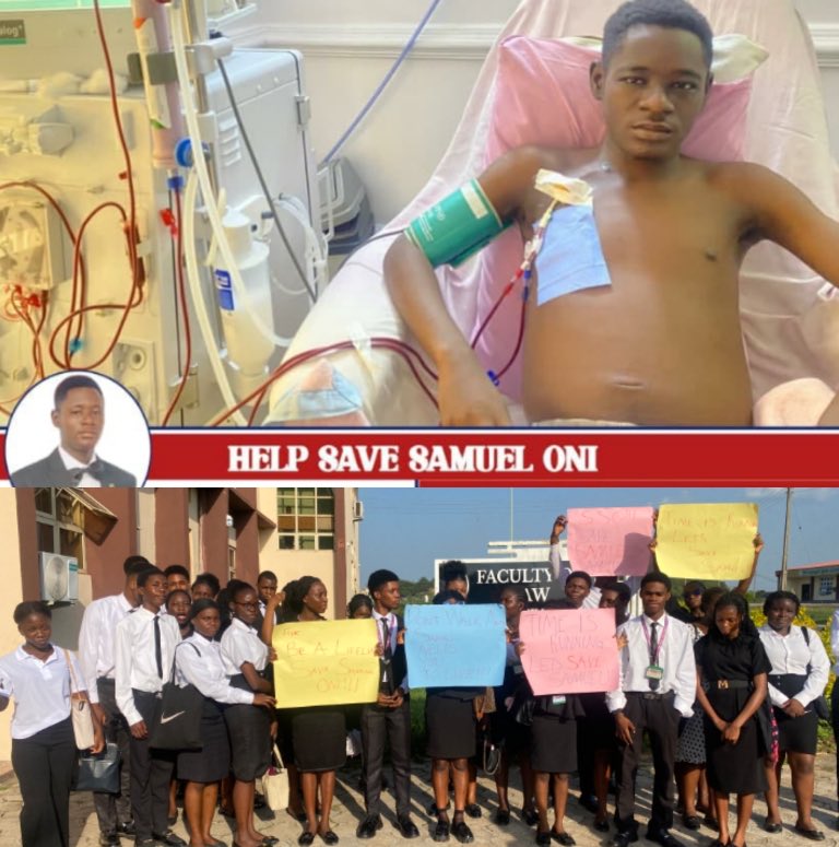 Omalichn's tweet photo. @AmiOmotola @TheoAbuAgada @muhammadpate Cursed tribe of Nigeria..so you ppl even begged for donations last year to save this sick Samuel Oladotun, along with other victims of yoruba signature chronic kidney disease from Agbo drinking. Yet your empathy seems to disappear when it doesn’t suit your agenda. Waka!! https://t.co/zVIAaekHX1