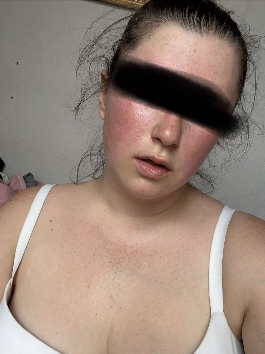 princesslilypff's tweet photo. Hot, sweaty and out of breath pig just from only half an hour walking in the heat today 🥵🐷 https://t.co/g37mjTxw0U