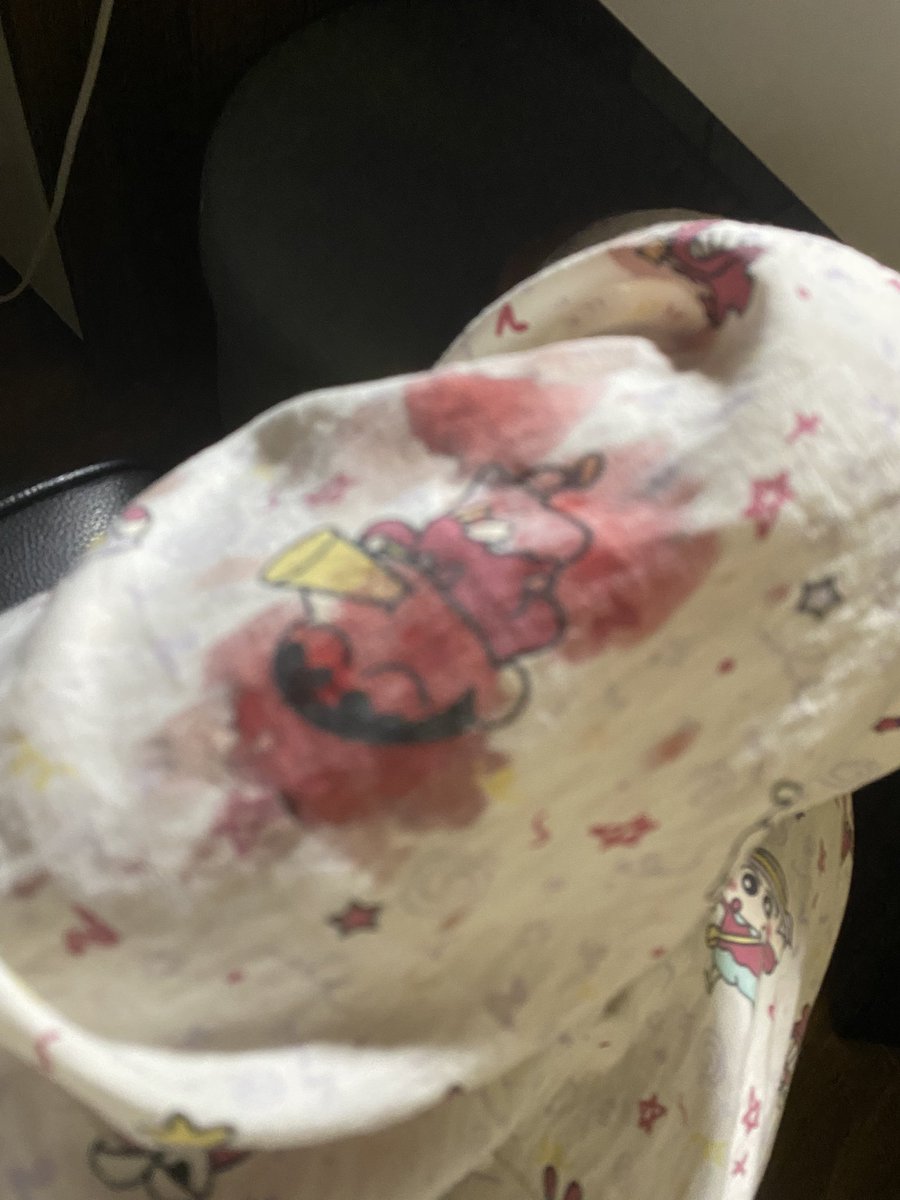 aaxxesse's tweet photo. scabbed + 1 week old btw can you not be a dramatic fuck https://t.co/ax2HuwPB9X