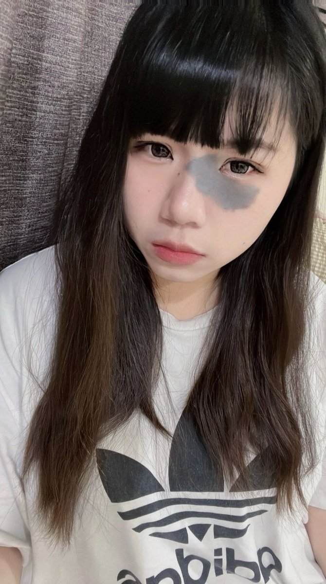 NoviaSaroy90218's tweet photo. 有人叫我不要出來嚇人  
但是我想說  
我只是跟你們不一樣  多了一個 胎記 
我沒有做錯什麽 https://t.co/BV4pRE9Y6V
