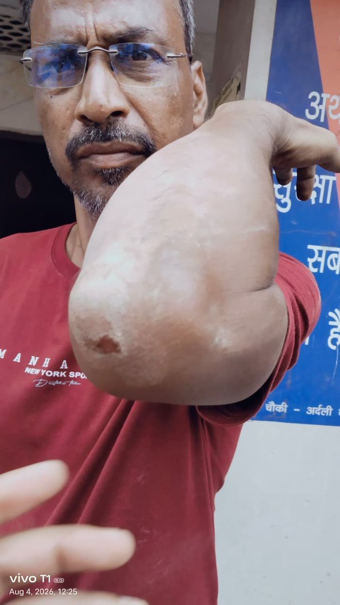 123e4t5's tweet photo. वाराणसी में भू-माफिया हमारी जमीन-दुकान पर कब्जे का प्रयास कर रहे हैं। महिलाओं से अभद्रता, बच्चों से मारपीट और जान से मारने की धमकी दी जा रही है। शिकायत के बावजूद स्थानीय पुलिस कार्रवाई नहीं कर रही। कृपया तत्काल कार्रवाई करें।@Uppolice @adgzonevaranasi @varanasipolice @DcpVns https://t.co/GilUJzuOuh